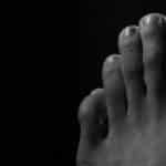 פטריה בין אצבעות הרגליים תרופות סבתא