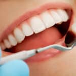 טיפולי שיניים בטורקיה המלצות
