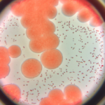 staphylococcus-streptococcus